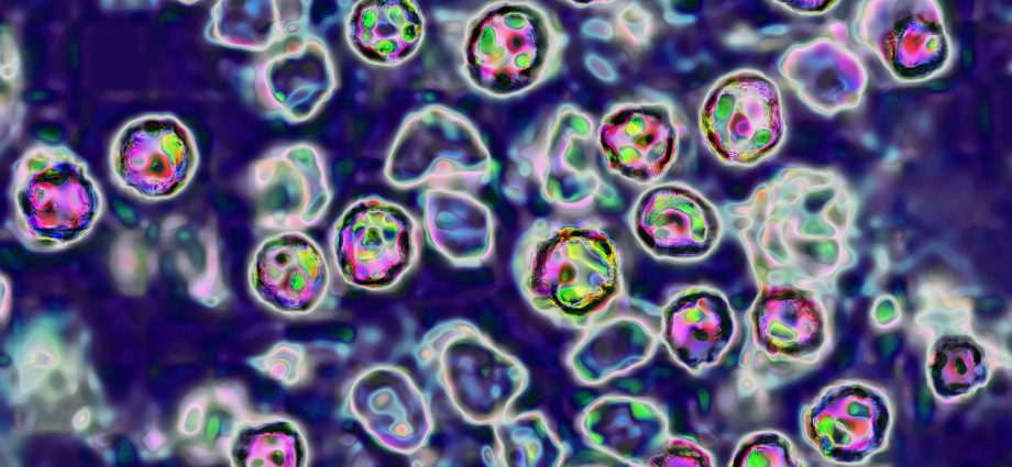 40-year-old-pennsylvania-woman-dies-from-measles-complications