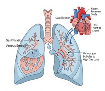 risks-of-decompression-sickness-and-venous-thromboembolism-during-spaceflight-and-patent-foramen-ovale-implications