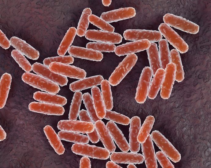 russian-lab-worker-dies-of-suspected-plague-as-200-enter-medical-observation