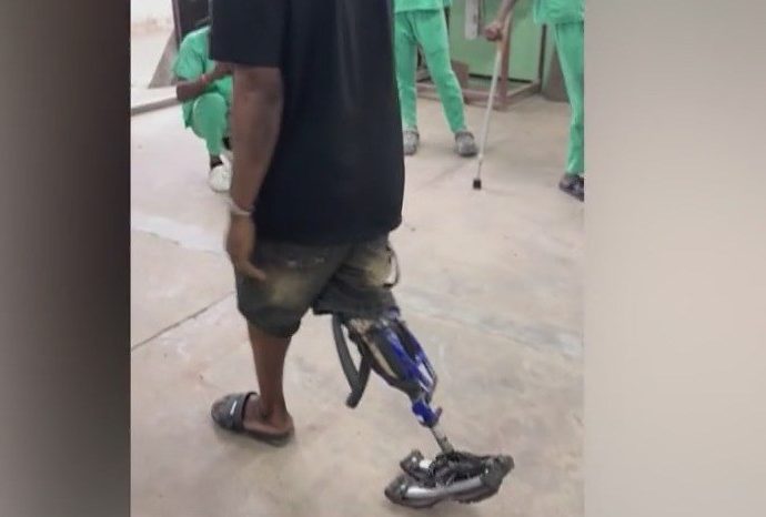 ex-bicycle-mechanic-makes-prosthetic-legs-from-—-what-else?-—-bike-parts