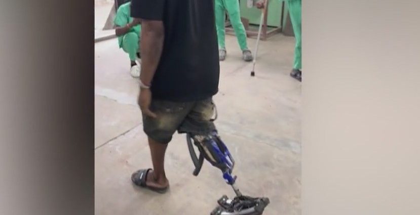 ex-bicycle-mechanic-makes-prosthetic-legs-from-—-what-else?-—-bike-parts