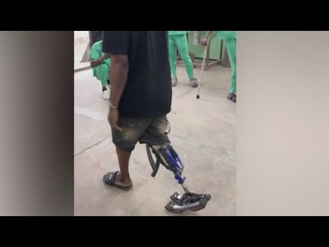 ‘bike-leg’:-prosthetics-tech-develops-artificial-limbs-with-bicycle-parts-|-jesse-weber-live