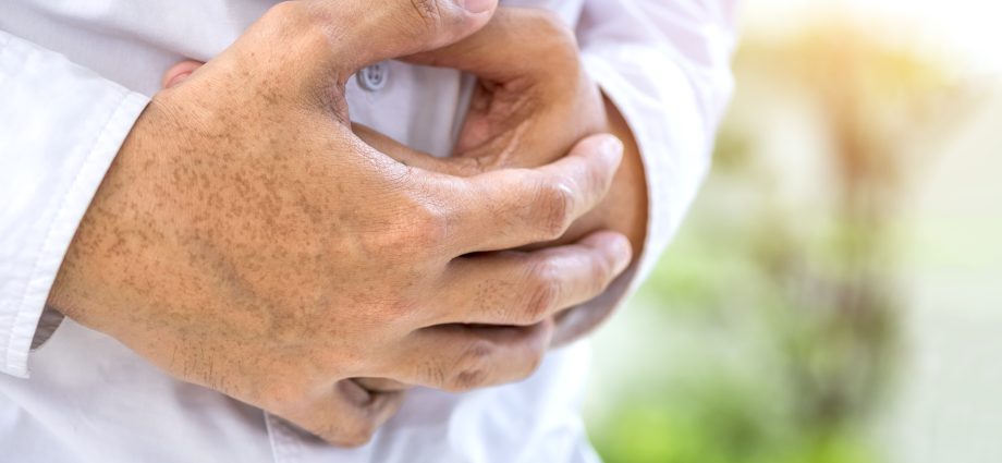 a-second-opinion-gave-one-man-a-second-chance-after-terminal-cancer-diagnosis