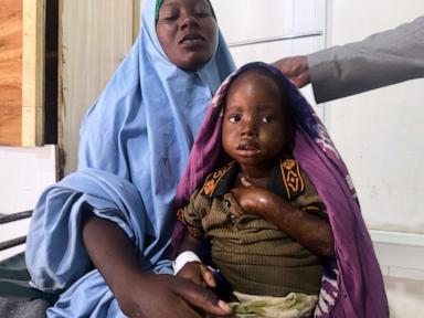 mother’s-3-day-walk-with-sick-child-highlights-somalia’s-child-malnutrition-emergency