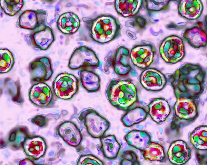 pennsylvania-reports-sixth-measles-related-death