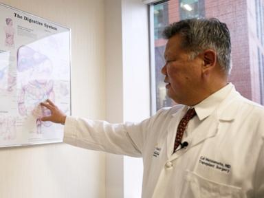 how-the-us-organ-transplant-system-works-and-what-to-ask-to-improve-your-chances